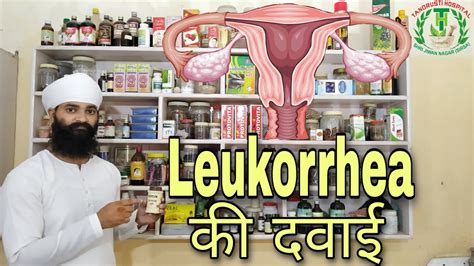 Medicine For Leukorrhea सफ़ेद पानी प्रदर का ईलाजleukorrhea White