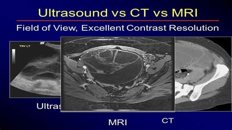 Best Photos Cat Scan Vs Mri Vs Xray Ct Scan Vs Ultrasound Hot Sex Picture