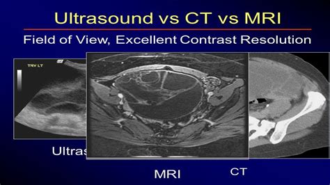 Ct Scan Vs Mri Core Plastic Surgery