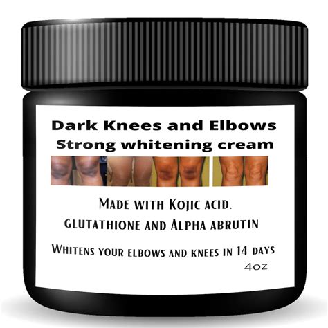 Dark Knees And Elbows Cream Fast Action Extreme Whitening Etsy