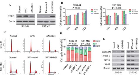 overexpression of n‑myc downstream‑regulated gene 1 inhibits human glioma proliferation and