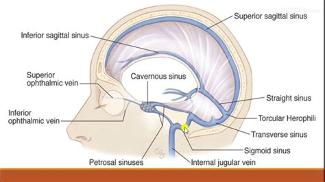 Cavernous Sinus Sagittal