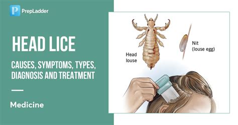 Head Lice Causes Symptoms Transmission Risk Factors Diagnosis