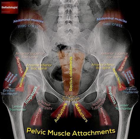 Unfortunately, the indirect view onto the anatomy in addition to projective simplication substantially. Pelvic X-ray Anatomy #Ashiry - Radiology Students Of A.M.S ...