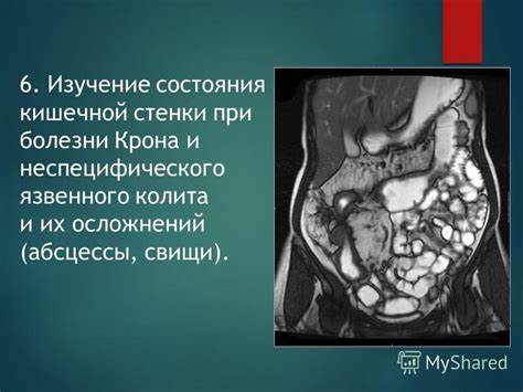 Диета при неспецифического язвенного колита Презентация на тему: "Методы рентгенологического исследования желудочно Презентация на тему: "Методы рентгенологического исследования желудочно Диета при неспецифического язвенного колита