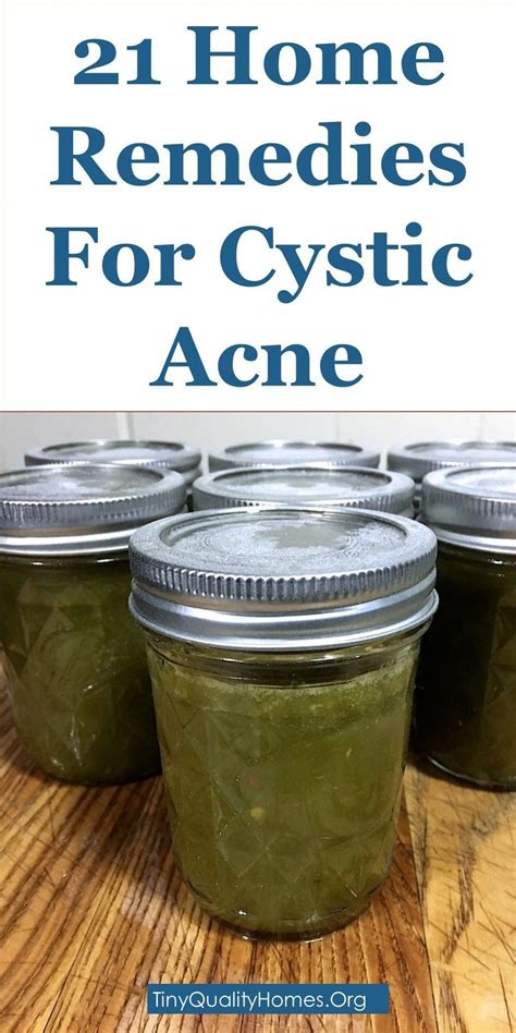 21 Potent Home Remedies For Cystic Acne Homemadewrinklecreams Cystic