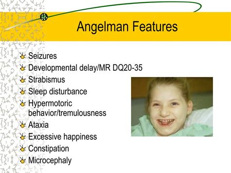 Ppt Angelman Syndrome Powerpoint Presentation Free Download Id289839