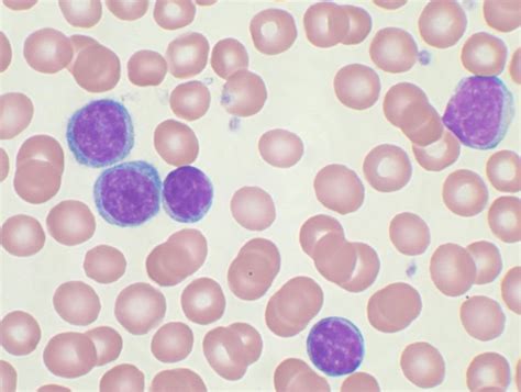 White Blood Cells Granulocytes Agranulocytes Teachmephysiology