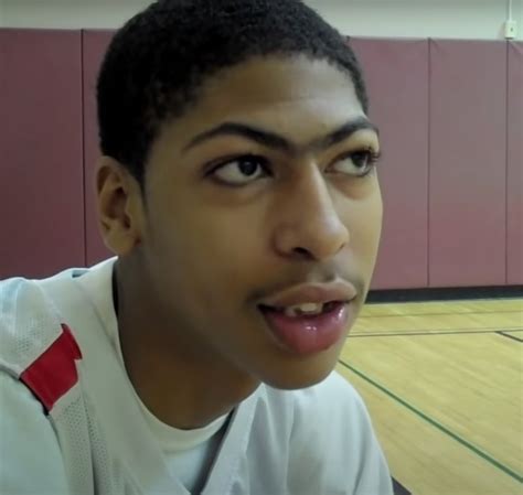Anthony Davis Teeth Transformation Updated Before And After