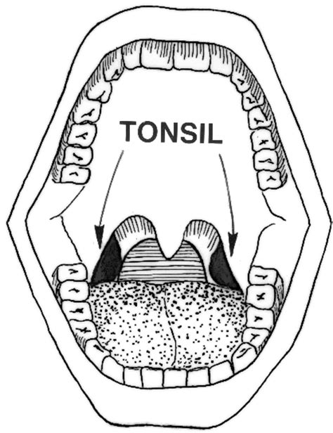 Tonsils Clipart 20 Free Cliparts Download Images On Clipground 2023