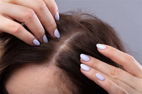 What Causes Hair Thinning At The Crown For Females