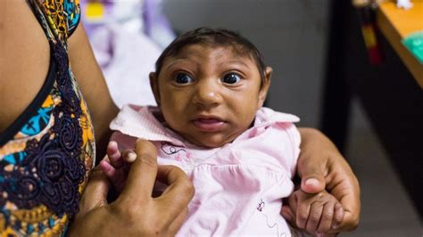 How Does Zika Cause Birth Defects