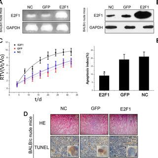 Apoptosis Of LV E2F1 GFP Cells And Tumors In Nude Mice In Vivo A MRNA