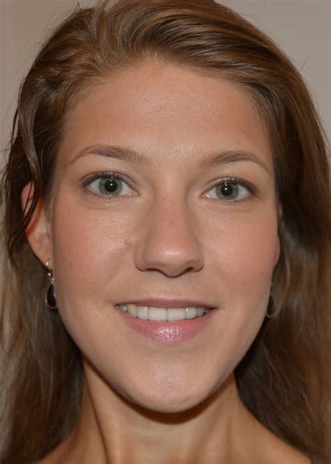 Arbeiten organe des körpers nicht so gut, kann sich dies im gesicht widerspiegeln. briandbradyy: Pickel Im Gesicht Im Urlaub