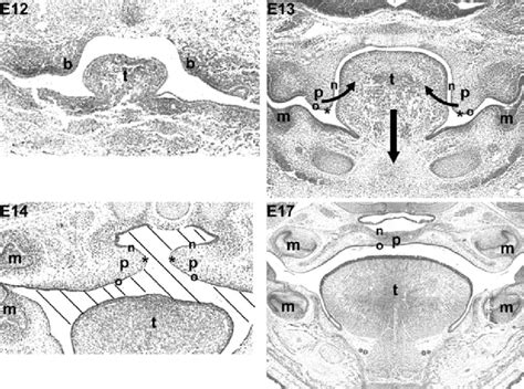 Palate Development In Mouse Palatal Shelves Begin To Develop As A Bud