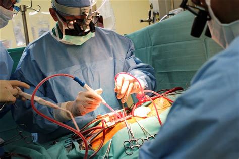 3 Exciting Technological Advancements In Cardiac Surgery That Makes You