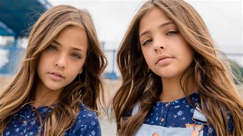 ≡ What Are The “worlds Most Beautiful Twins” Up To Today 》 Her Beauty