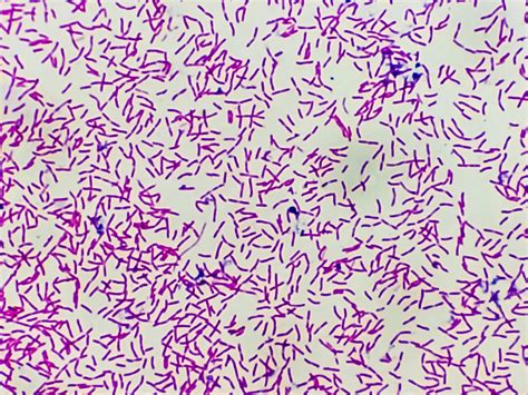 Premium Photo Microscopic View Of Gram Stain Showing Rod Shape