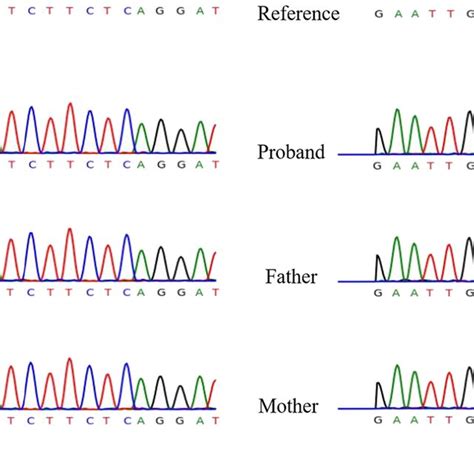 Sanger Sequencing Confirmed The Mutation Of The Proband And Verified Download Scientific