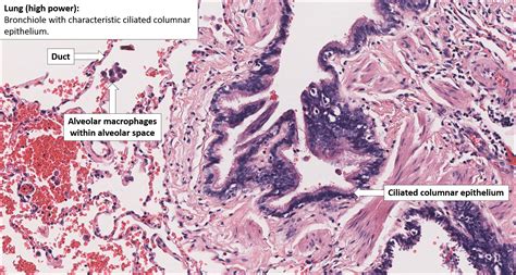 Lung Normal Histology Nus Pathweb Nus Pathweb