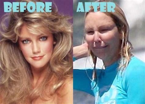 Heather Locklear Plastic Surgery Before And After Photos Lovely