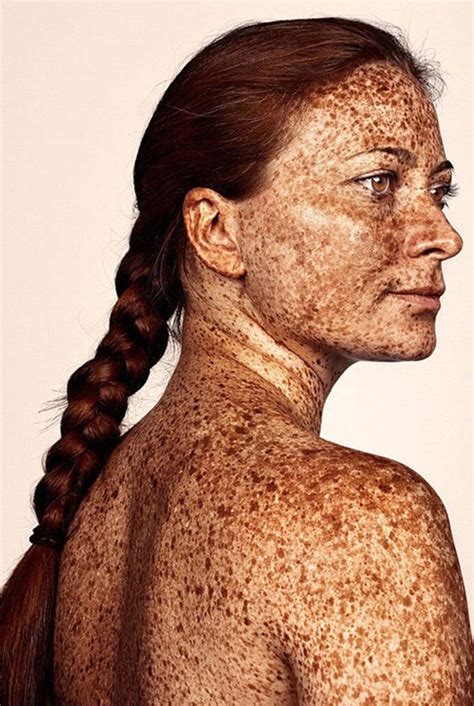98 Freckled People Wholl Hypnotize You With Their Unique Beauty Beautiful Freckles Portrait