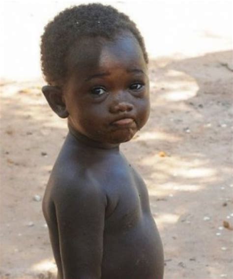 La Verdad Detrás De Las Fotos De El Bebé Más Negro Del Mundo Su Piel
