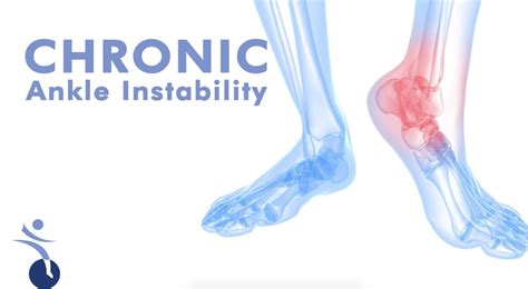 Chronic Ankle Stability Podiatry Hq