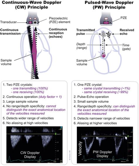 Physical Principles Of Ultrasound And Generation Of Images Thoracic Key