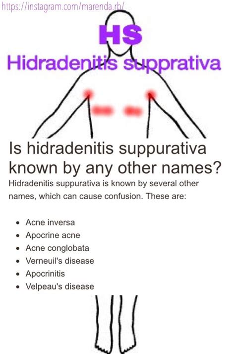 Hidradenitis Hidradenitissupprativa Skin With Images Acne