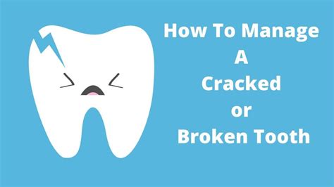 How To Manage A Cracked Or Broken Tooth All Smiles Dent Spa
