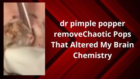 Dr Pimple Popper Remove Chaotic Pops That Altered My Brain Chemistry