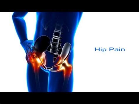 I've been suffering from hip pain for a year now and it's really starting to wear me down. 5 Steps to Hip Pain Relief - YouTube