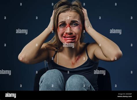 Scared Blonde Woman Bleeding Face Covered With Bruises In Black