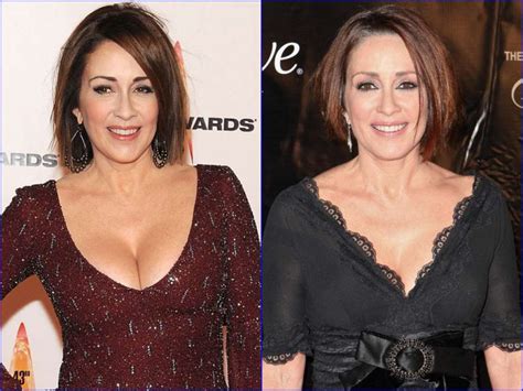 Patricia Heaton Before And After Breast Reduction Surgery