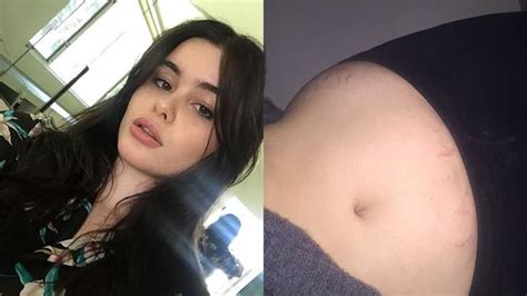 7 Models Who Embraced Their Stretch Marks Elle Australia