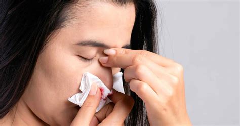 Epistaxis Qué es Causas y tratamiento Blog Clínica Internacional