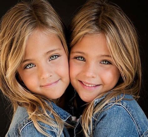 They Were Considered The Worlds Most Beautiful Twins 8 Years Ago See What They Look Like Now