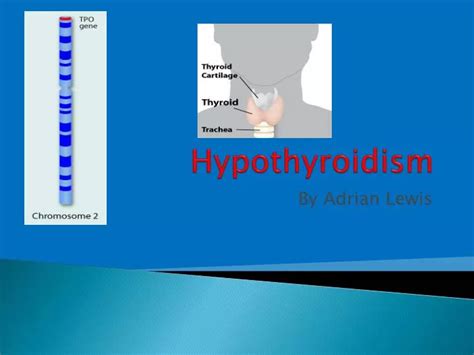 Ppt Hypothyroidism Powerpoint Presentation Free Download Id2206775