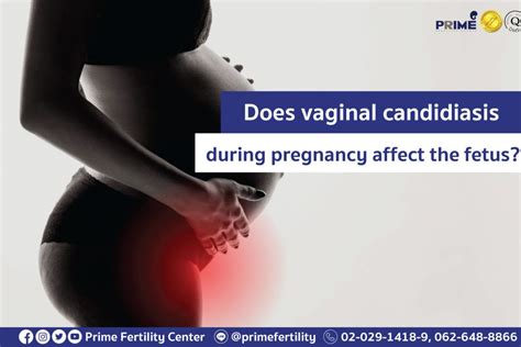 Does Vaginal Candidiasis During Pregnancy Affect The Fetus