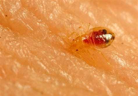 Bed Bug Bite Pictures Symptoms Treatment