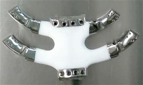 Csiro And Anatomics 3d Print Titanium And Polymer Sternum Implant In