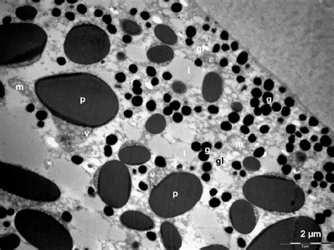 Cytoplasm Of A Blastomere Of Bufo Bufo Showing Large Yolk Platelets P Download Scientific