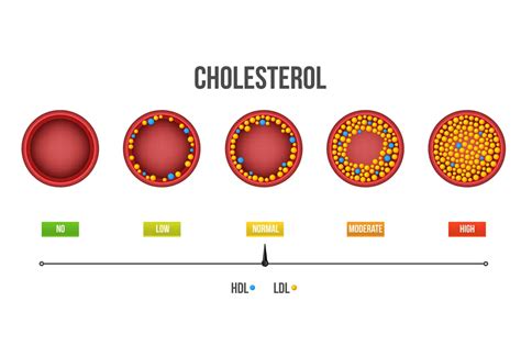 What Is Cholesterol And How Can It Be Controlled Lifeworks