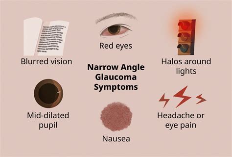 Glaucoma Diagnosis