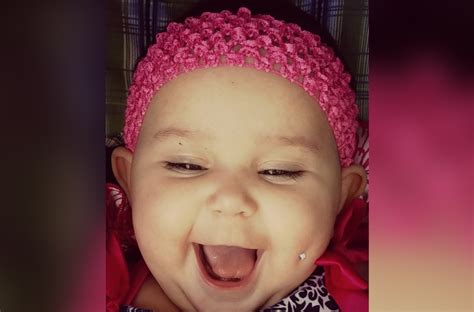 Baby With Pierced Dimple Sparks Big Debate On Social Media