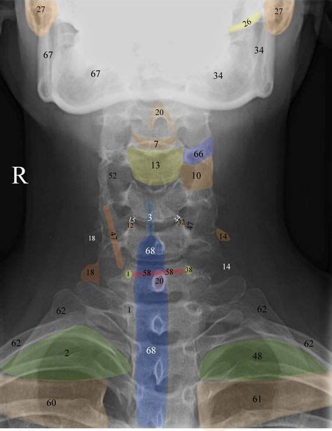 Normal Radiographic Anatomy Of The Cervical Spine Radiología