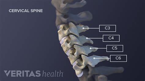 Typical And Atypical Cervical Vertebrae Rwanda 24