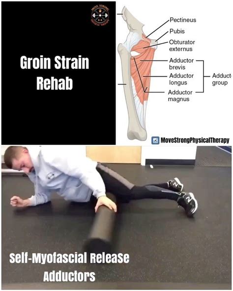 Move Strong Physical Therapy On Instagram Groin Strain Rehab Groin Or