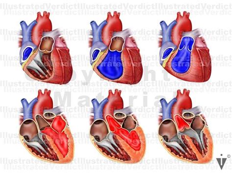 Stock Heart Normal Anatomy — Illustrated Verdict